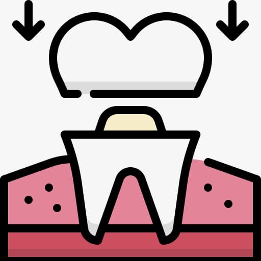 Crowns