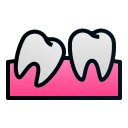 Impacted Teeth