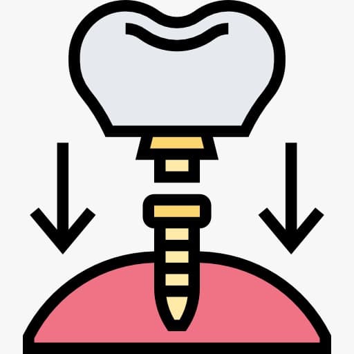 Implants