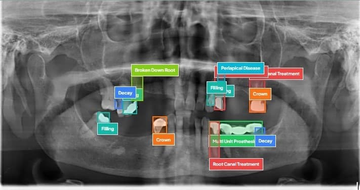 Dental AI