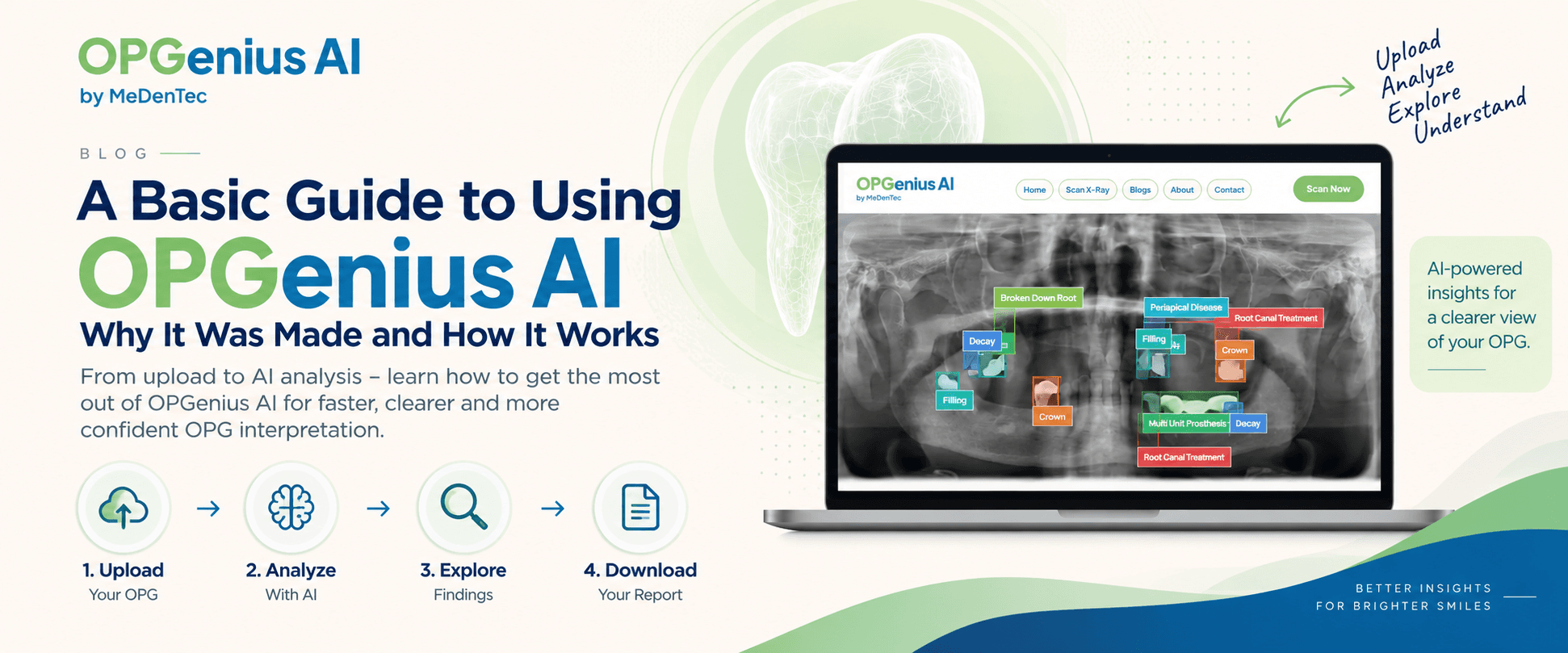 A Basic Guide to Using OPGenius AI: Why It Was Made and How It Works