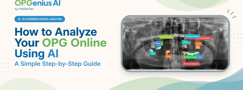How to Analyze Your OPG Online Using AI: A Simple Step-by-Step Guide