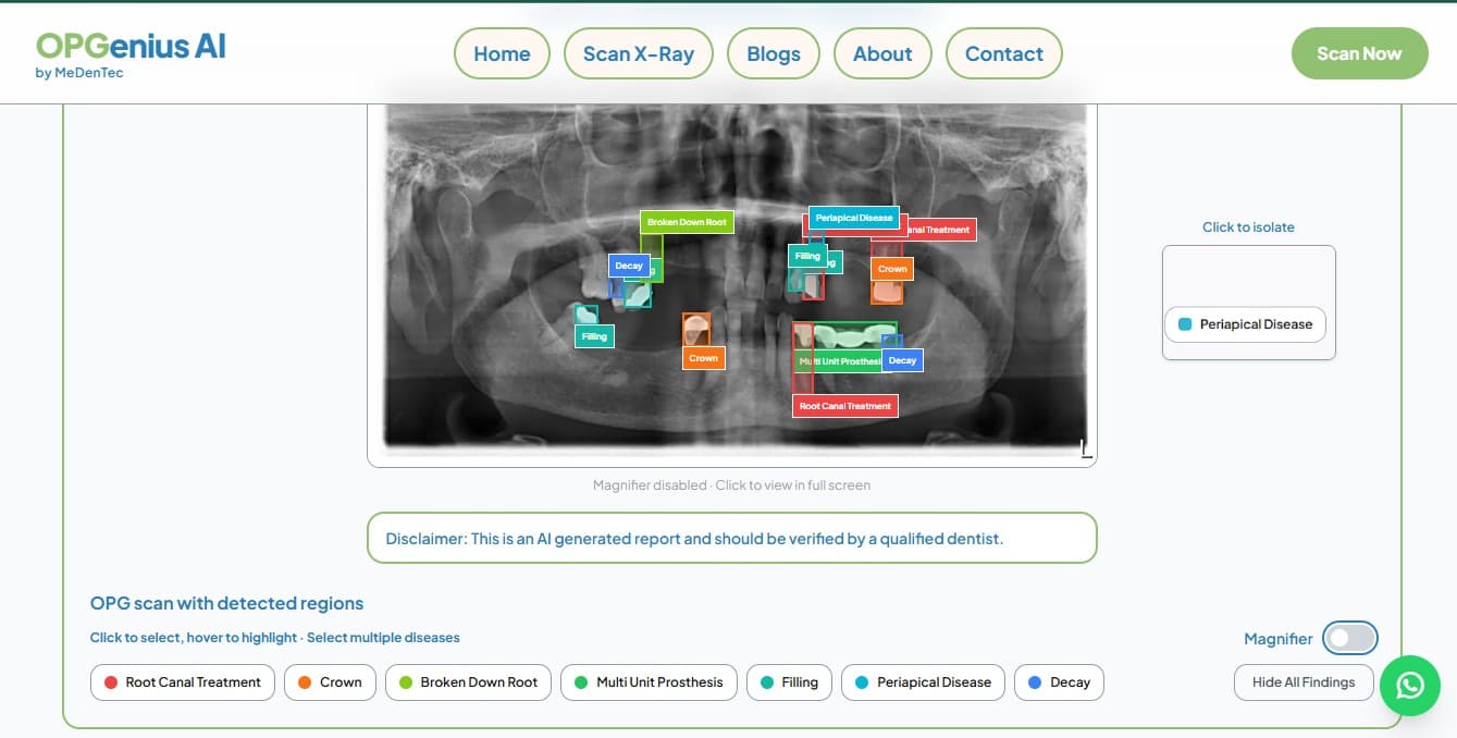 OPG with AI findings