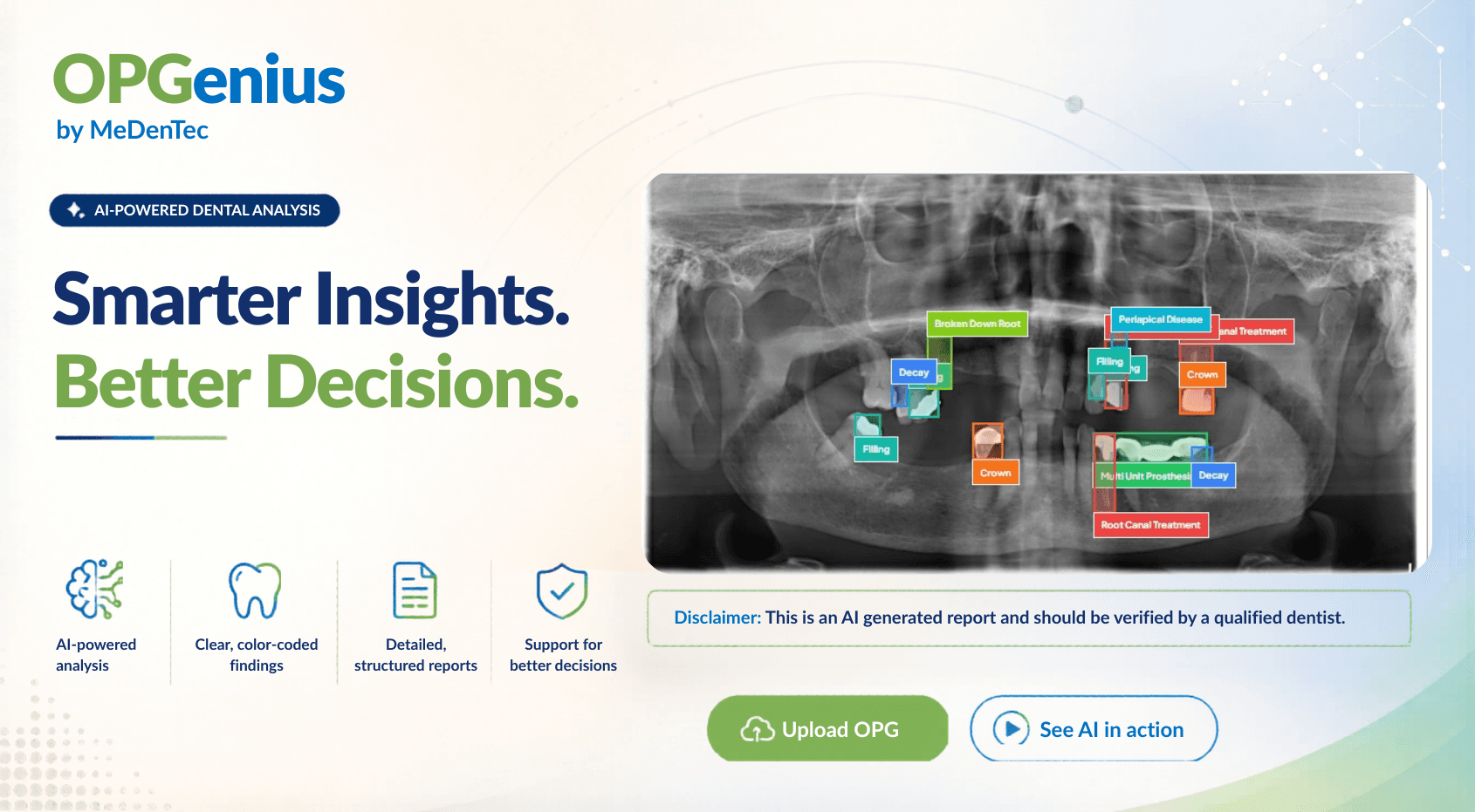 Making Dental OPGs Easier to Understand with Artificial Intelligence