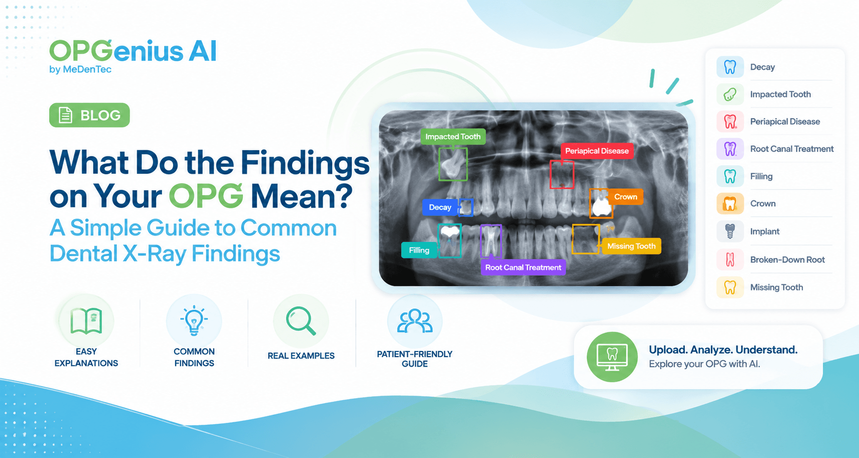 What Do The Findings On Your OPG Mean?