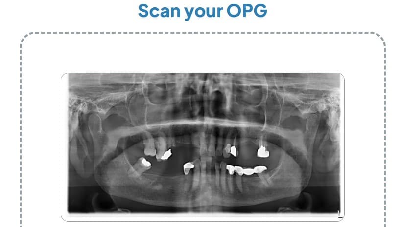 Upload your OPG