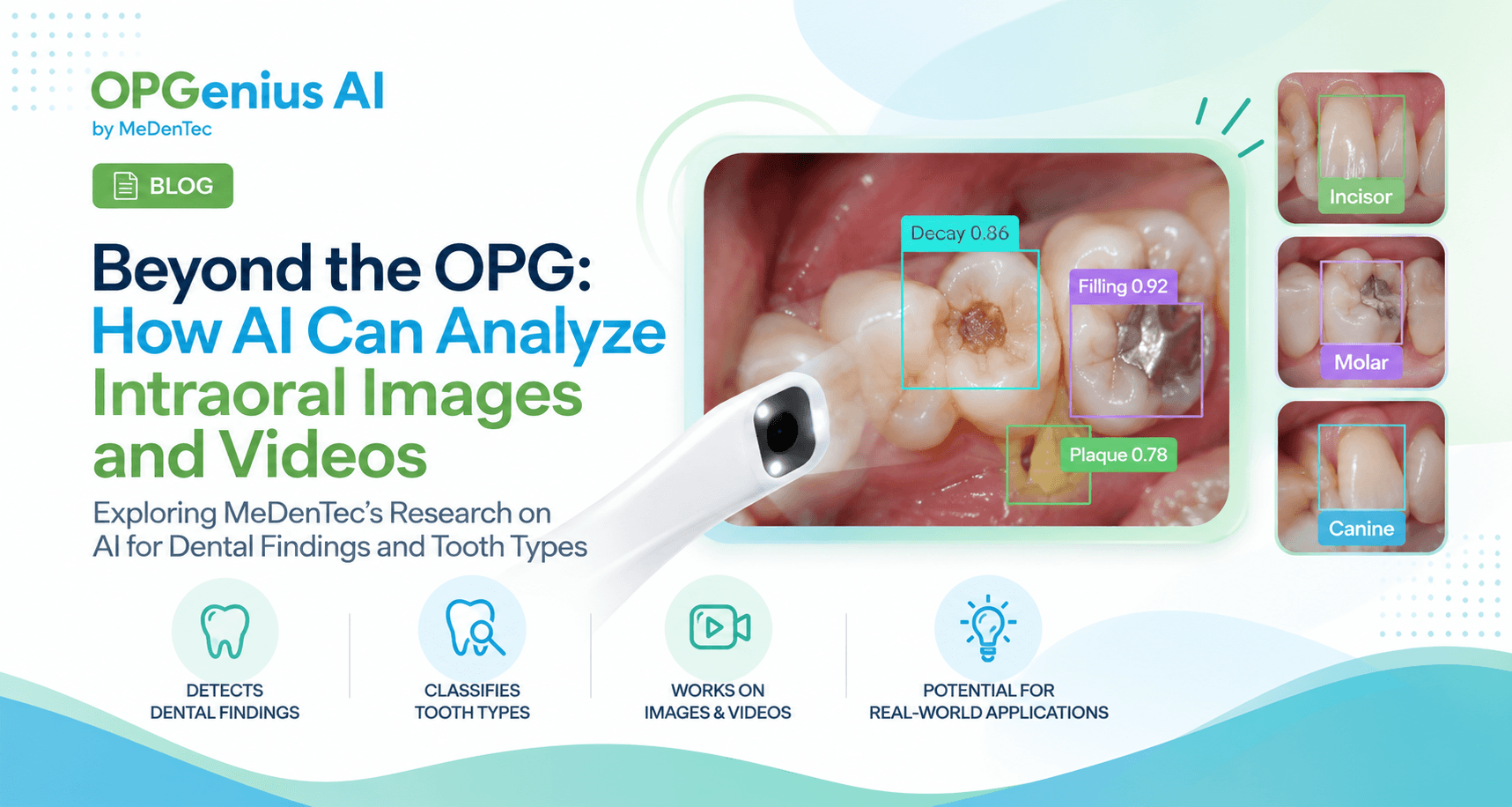 Beyond the OPG: How AI Can Analyze Intraoral Images and Videos